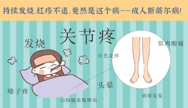 持續(xù)發(fā)燒、紅疹不退……她終于在這里治好了這個罕見病