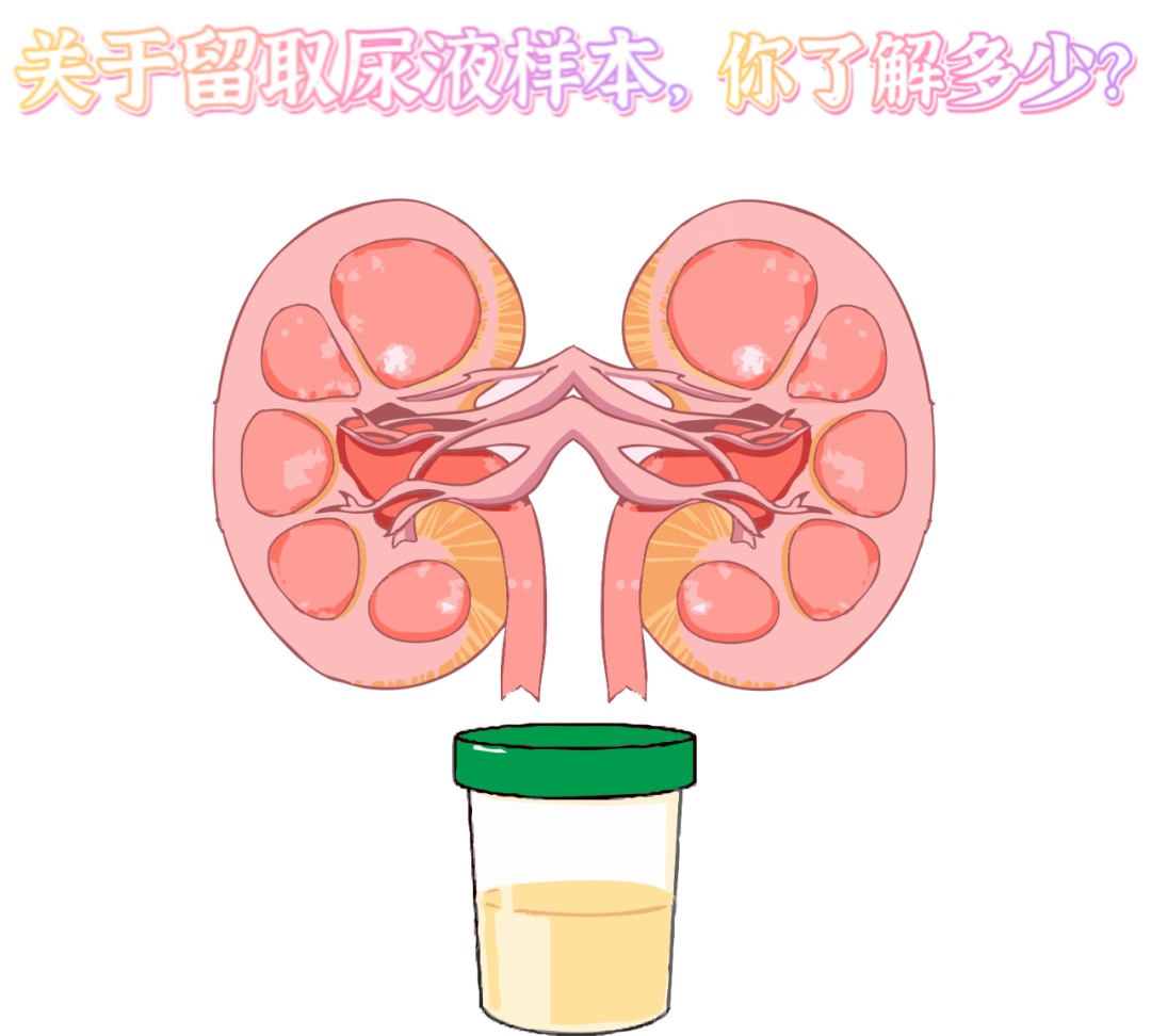 做尿檢，不得不說的注意事項！