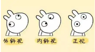 小baby老歪著頭？警惕斜頸! 這樣糾正……