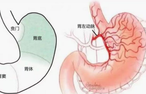 不開刀不吃藥不餓肚子，微創(chuàng)介入減肥靠譜嗎？