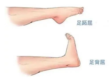 扭胯小連步、動(dòng)感搖花手……“科目三”雖火，運(yùn)動(dòng)損傷也要防！